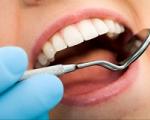 دهان و دندان/ سنگ فرشی که سلامت دهان را تهدید می‌کند