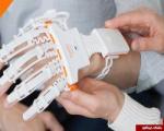گوناگون/ طراحی دستکش هوشمند برای توانبخشی بیماران