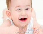پوسیدگی دندان ها در کودکان