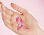 بانوان/ کاهش سن ابتلا به سرطان سینه در زنان ایرانی