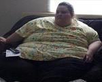 وضعیت چاق ترین دختر دنیا بعداز کاهش وزن