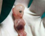 تصویری عجیب از جنین سقط شده 7 هفته‌ای!