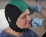 تائید کلاه خنک کننده برای کاهش ریزش موی زنان در پی شیمی درمانی