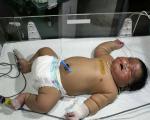 بزرگ‌ترین نوزاد تاریخ هند با وزن ۶.۷ کیلوگرم متولد شد