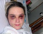 حوادث/ ضرب و شتم وحشیانه زن توریست پس از ساعت‌ها تعرض در مراکش