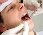 دهان و دندان/ آنچه لازم است درباره جرم گیری دندان بدانید