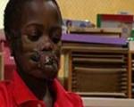 4گوشه دنیا/ عمل جراحی 14 ساعته کودکی که شامپانزه‌ها به او حمله کرده بودند