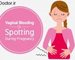 عواقب خونریزی داشتن یک زن حامله