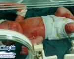 سوختگی و مرگ یک نوزاد در بیمارستان صومعه سرا ! / شایعه 0453
