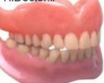 توصیه هایی در مورد بهداشت و نظافت دندان های مصنوعی