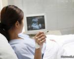 سیگار کشیدن در بارداری موجب کوتاهی قد جنین می شود؟
