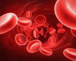سلول‌های خونی چه افرادی شسته می‌شود؟