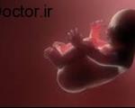 مامان و نی نی/ آسیب های مختلف جنین در بارداری
