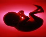 بارداری/ یک چهارم بارداری ها سقط می شوند