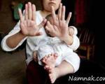 تولد عجیب نوزادی با 31 انگشت! + تصاویر