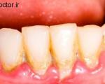 به افزایش کیفیت سلامت دهان و دندان خود کمک کنید