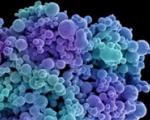 نارنجک میکروسکوپی؛روش جدید هدف قرار دادن سلول‌های سرطانی