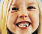 کودک/ حفظ دندان‌های شیری برای داشتن دندان های زیبا در آینده فرزندتان, یک ضرورت است!!