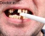 دهان و دندان/ از دست دادن دندان با استعمال دخانیات